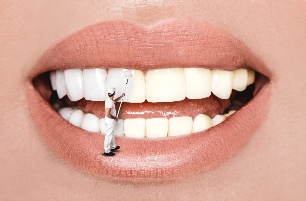 Woman smiling as a tiny man stands on her lower lip and uses a paint roller to whiten her teeth
