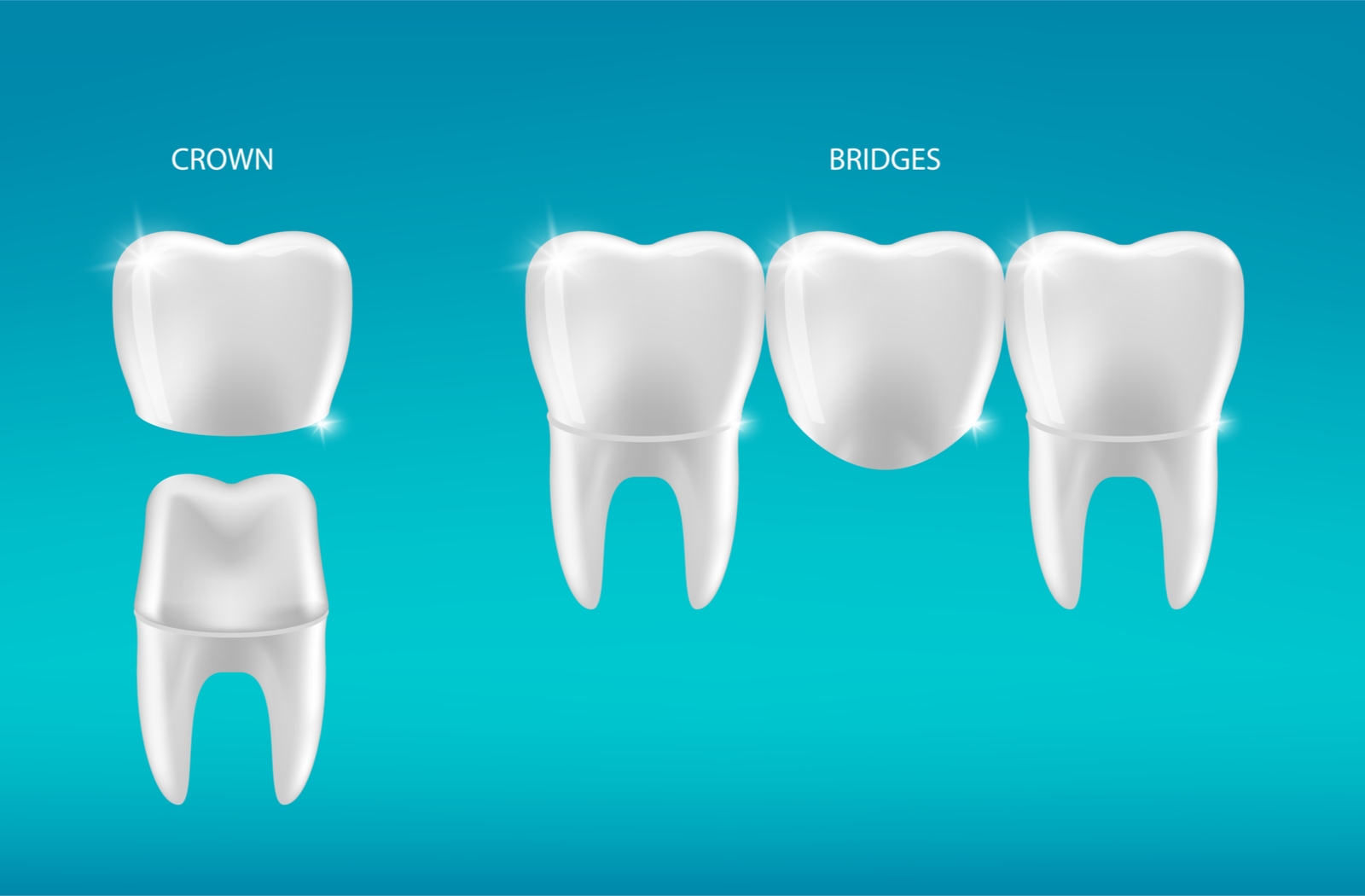 A illustration of a dental crown next to a dental bridge to highlight the difference between the two