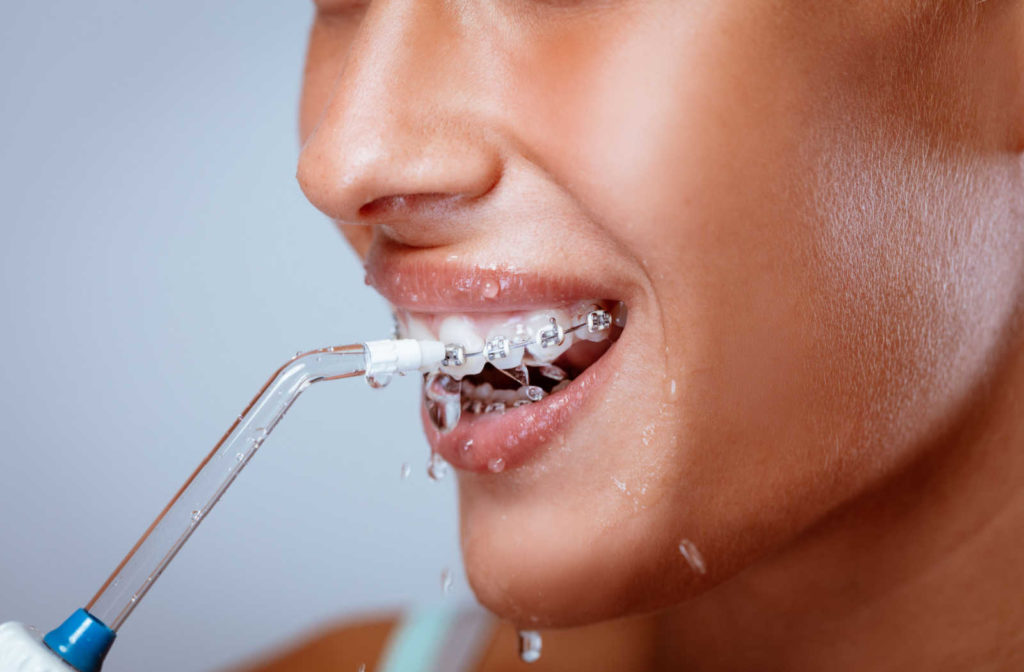 A person with braces on their teeth using a water flosser instead of traditional flossing to easily clean food particles out from between their teeth.