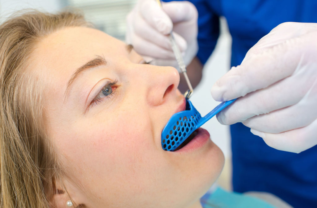 A close-up of a woman while the dentist is getting an impression of her teeth for her customized mouthguard.