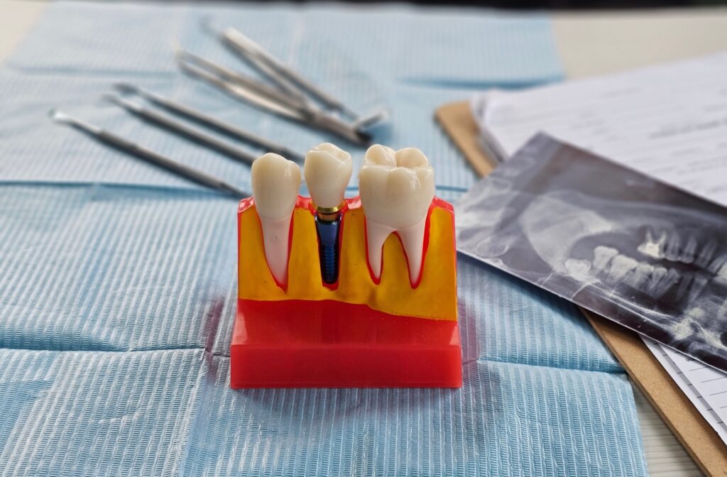 A bright model of a root canal sits on a table next to an X-ray, dental equipment, and some paperwork